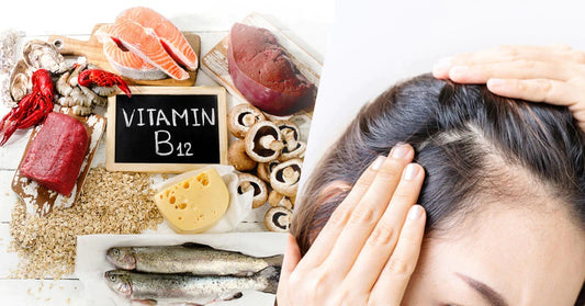 What Contains Vitamin B12? Which Foods Contain B12?